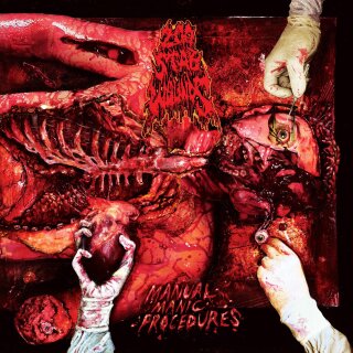 200 STAB WOUNDS -- Manual Manic Procedures  LP  SMOKE